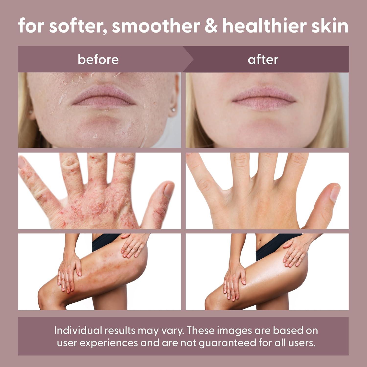 image100 Unscented Grass Fed Beef Tallow for Skin Body and Face Fragrance Free Moisturizing Honey Balm with ColdPressed Olive Oil and Beeswax Suitable For Dry Sensitive ampamp Irritated Skin 2 oz 57g