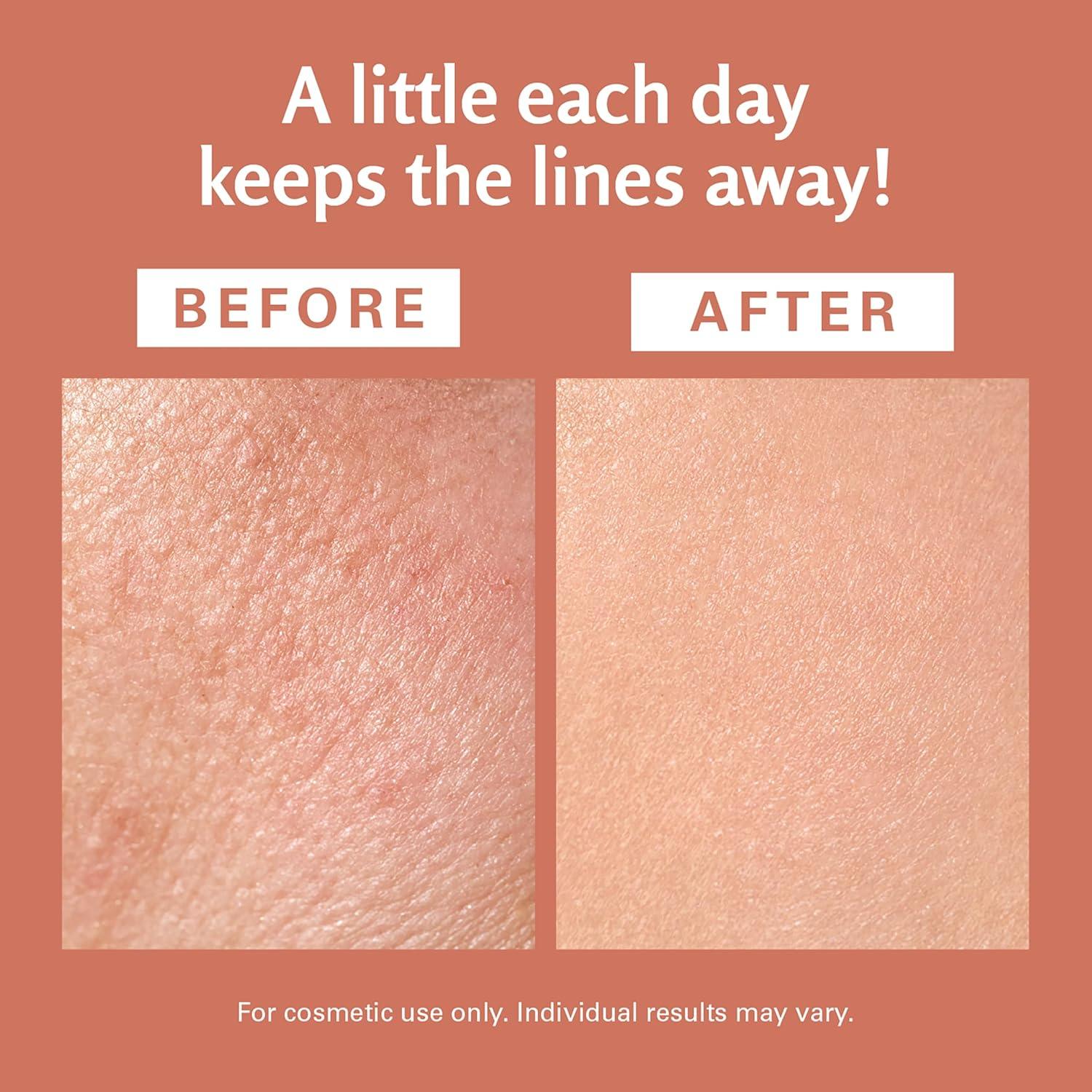 imageArnica Sore Muscle Massage Oil with Collagen Stem Cells and Menthol AntiCellulite Therapy for Full Body FastAbsorbing Multipurpose Treatment 8 fl oz by M3 NaturalsFrankincense Oil