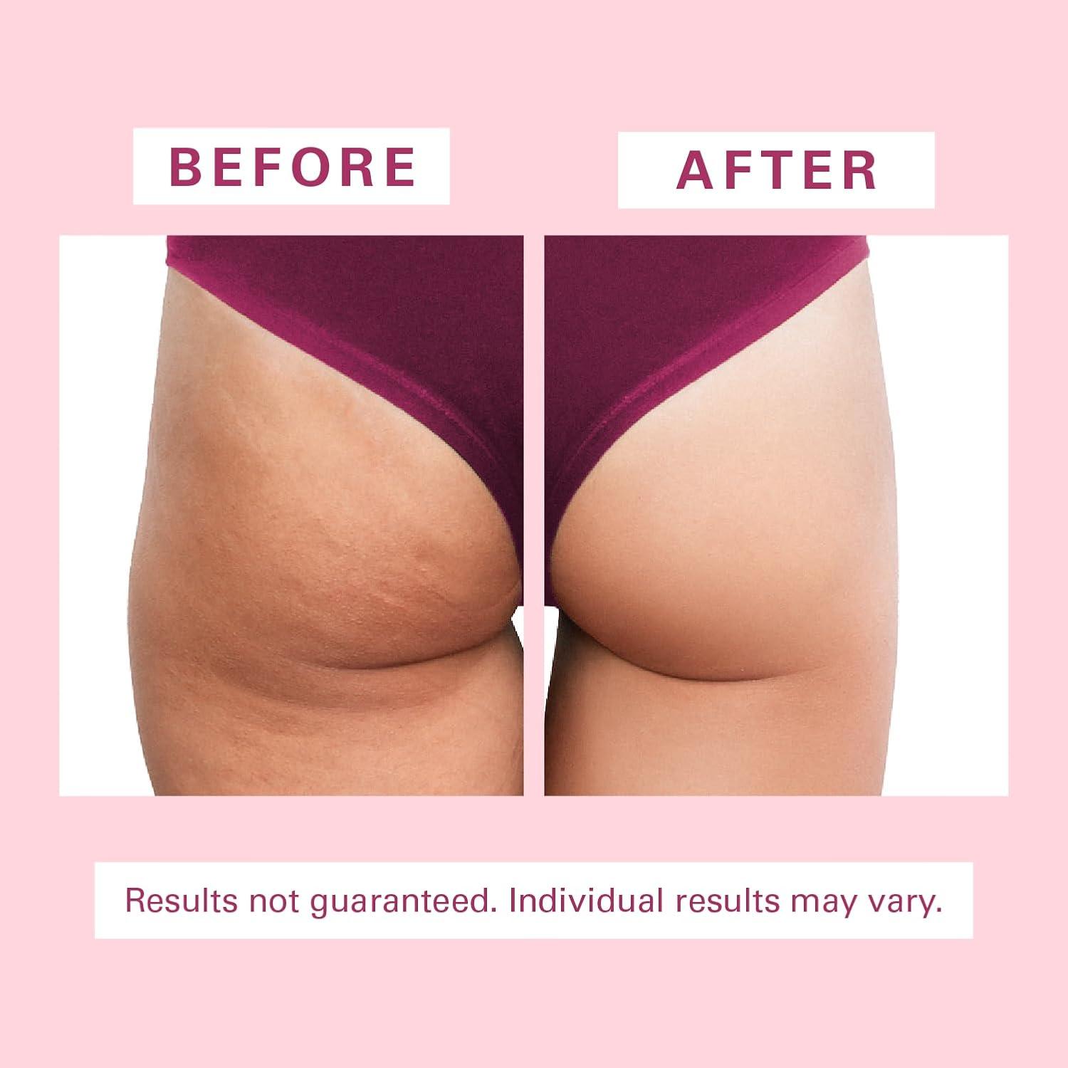 imageCellulite Massager Brush AntiCellulite Silicone Body Scrubber for Skin Smoothing Toning and Firming Handheld Exfoliator for Scalp and Muscles by M3 NaturalsSilicone Brush