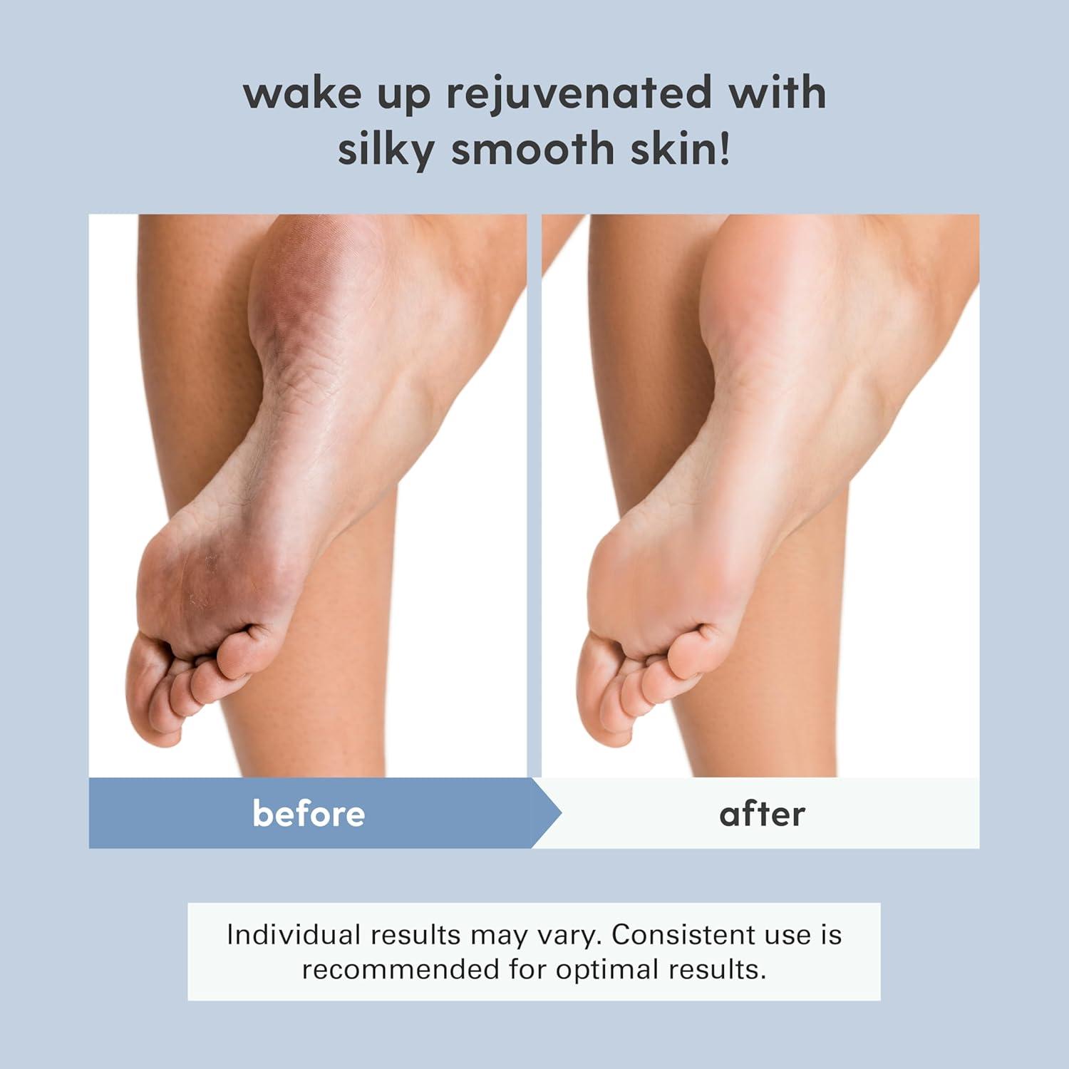 imageM3 Naturals Unscented Magnesium Lotion for Sleep ampamp Leg Cramps Suitable for Sensitive Skin Helps with Muscle Relaxation Soothes Tired Legs ampamp Foot Aches and Supports Restful Nights 8 fl ozMagnesium Oil Spray