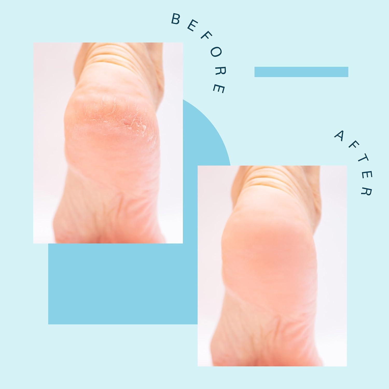 imageTea Tree Oil Foot Soak and Epsom Salts for soaking Foot Spa and Remedy for Athletes Foot Stinky Feet and Foot Soak for Dry Cracked Feet Detox Foot Soak and Tea Tree Oil for Healthy Toenails 16ozLavender